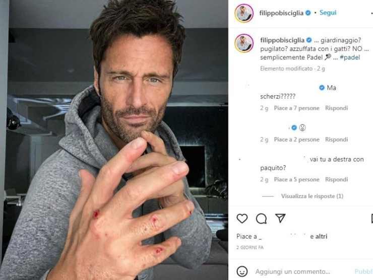 Filippo Bisciglia con le ferite causate dal padel (Instagram) 7.10.2022 crmag