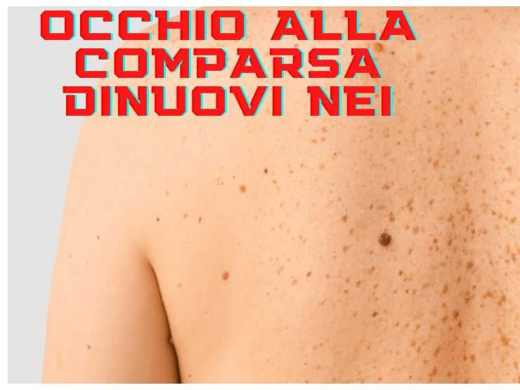 controllo nei dermatologo